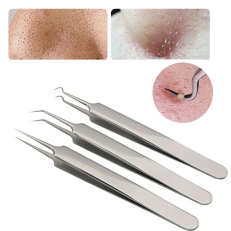 tweezers for blackheads